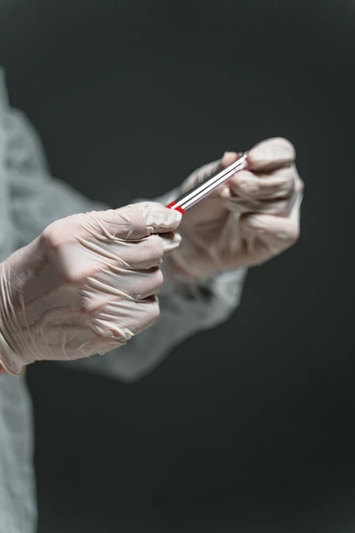 Decline in Hand, Foot and Mouth Disease (HFMD) Cases – Continued ...
